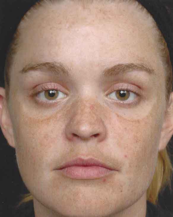 obagi nu derm for women