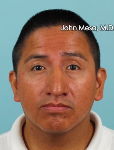 best botox clinic in new york