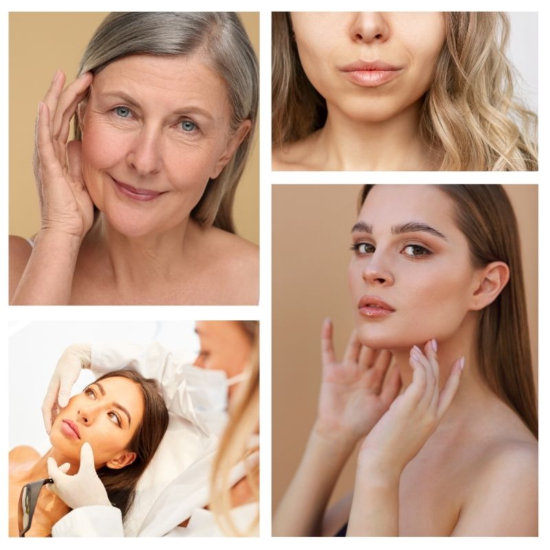 buccal fat removal for women