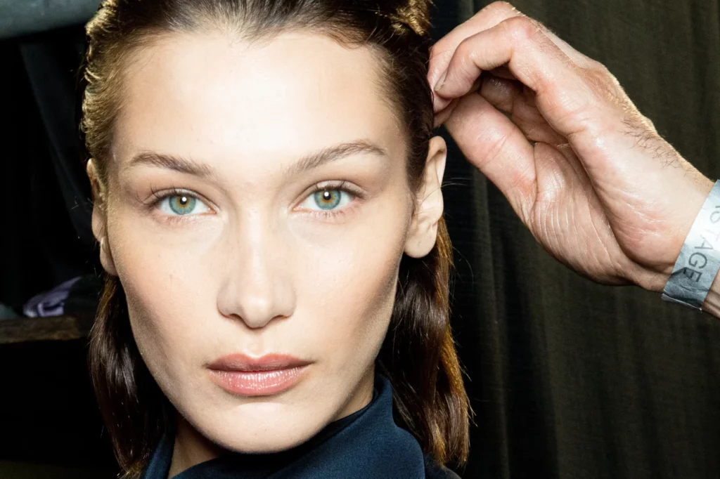 bella hadid buccal fat removal