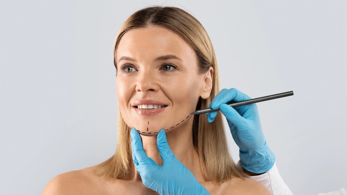 Chin Liposuction Consultation Tips and Insights in NYC